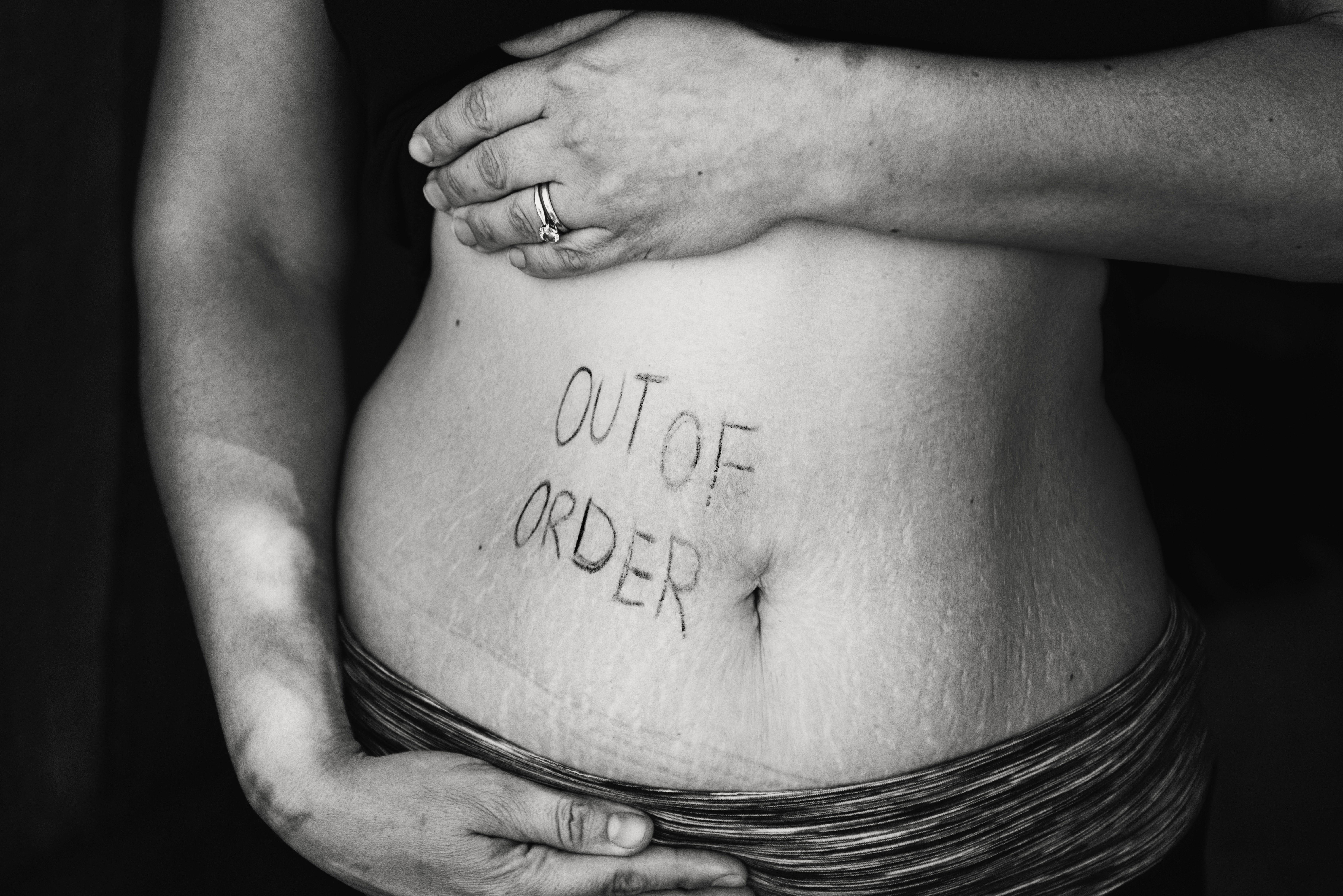 Abdomen Out of Order