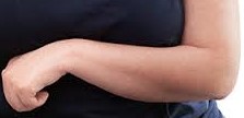 arm spasticity after stroke arm spasticity after stroke