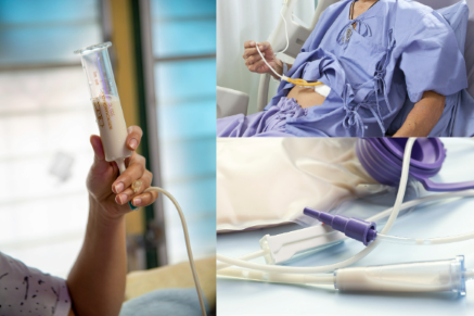 Feeding Tube  Feeding Tube