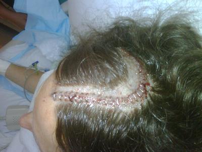 My Surgery