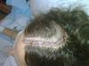 My Surgery